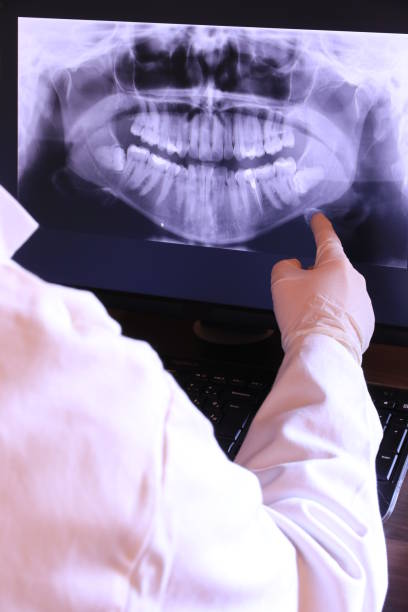 Best Emergency Tooth Extraction in Gulf Breeze, FL