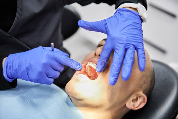 Best Emergency Dental Care for Broken or Chipped Teeth in Gulf Breeze, FL