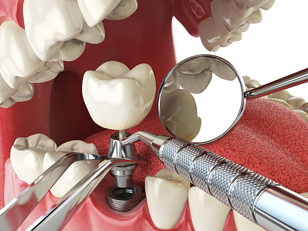 Best Cosmetic Emergency Dentistry in Gulf Breeze, FL